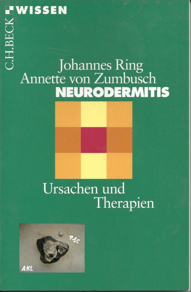Bild 1 von Neurodermitis, Ursachen und Therapie, Ring, Zumbusch